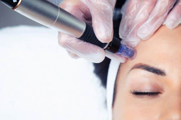 Explaining Total Skin Tightening Treatment and What to Expect 2 What Skin Concerns Can Total Skin Tightening Treatment Help With Salford?